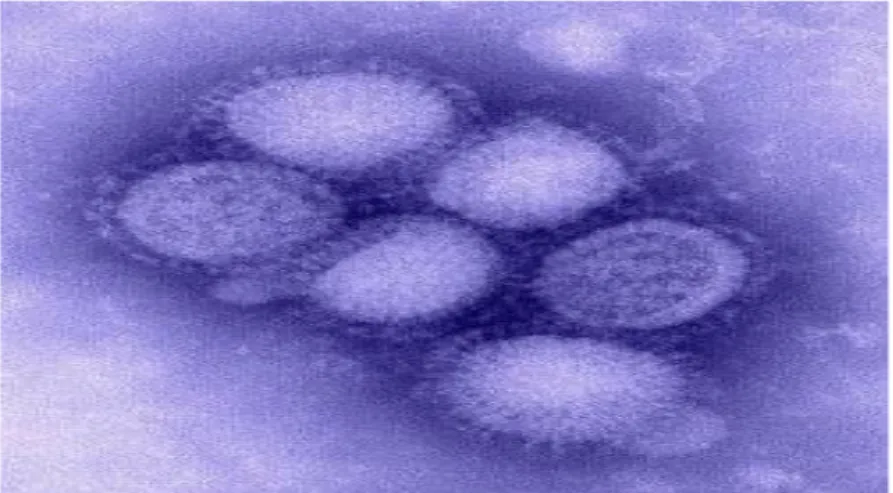 Fig. 1.1 Usutu virus (from Steinmetz HW et al. 2010) 