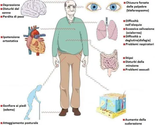 Figura 4: Sintomi non motori del morbo di Parkinson. 