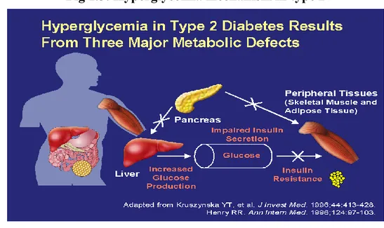 Fig 1.3: Hyperglycemia mechanism in type 2 