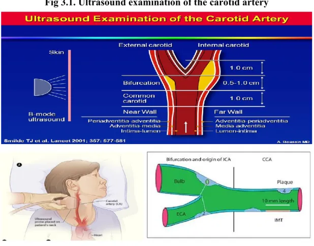 Fig 3.1. Ultrasound examination of the carotid artery 