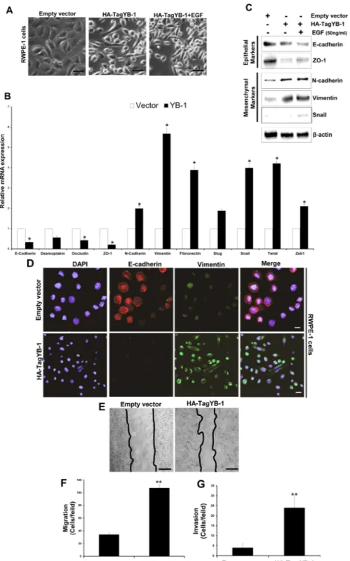 Figure 3: YB-1 induces EMT in non-tumorigenic prostate epithelial cells.  (A) Representative images showing the effect of  forced expression of YB-1 on mesenchymal like changes in RWPE-1 cells