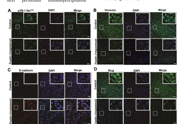 Figure 6: Fisetin treatment inhibits YB-1 phosphorylation and EMT in vivo.  (A) Representative immunofluorescent confocal  images showing the expression of p-YB-1 Ser 102  in tumor tissues from control and fisetin treated mice