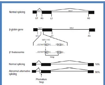 Figure 13. Alternative splicing of precursor  -globin mRNA resulting in  + -thal associated  with  the  IVS1–110  G→A  mutation