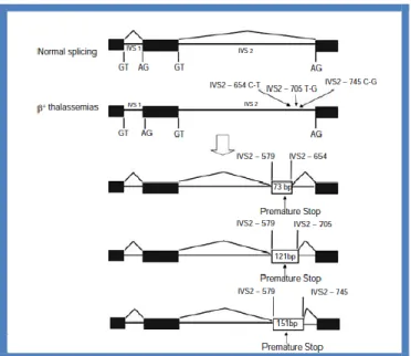 Figure 14. Alternative splicing of precursor -globin mRNA due to three base substitutions; 