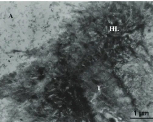 Figure 6: Tubules within the interface of Clearfil SE Bond exhibited extreme electron refraction due to the dense infiltration of the peritubular dentine