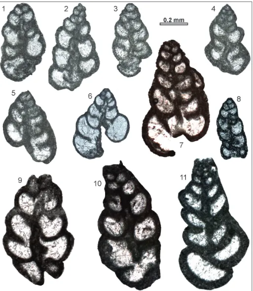 Fig. 9 - Siphovalvulina morphotype A. 