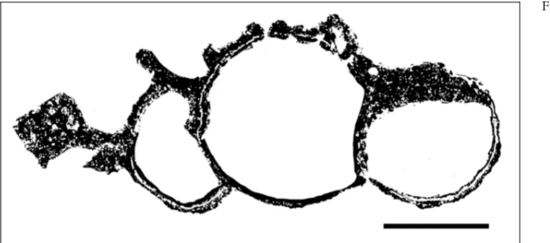 Pl. 5, figs 1, 4-5 1878 Sestrostomella robusta. Zittel, p. 41.