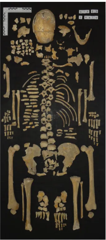 Fig. 10: Resti ossei della defunta inumata nella T. XXIV, disposti in posizione ana- ana-tomica (Archivio Labanof, Laboratorio di Antropologia e Odontologia Forense, 