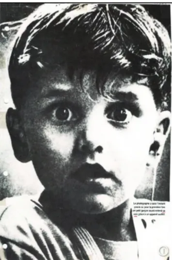 Figure 1. Petit garçon sourd entendant sa voix pour la première fois (Anonyme, 1990) 2