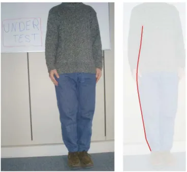 Figure 2.36 : Courbure du corps pour un trajet passant par la hanche (ligne rouge)  Les  zones  de  diffraction  sont  facilement  distinguables  sur  le  corps