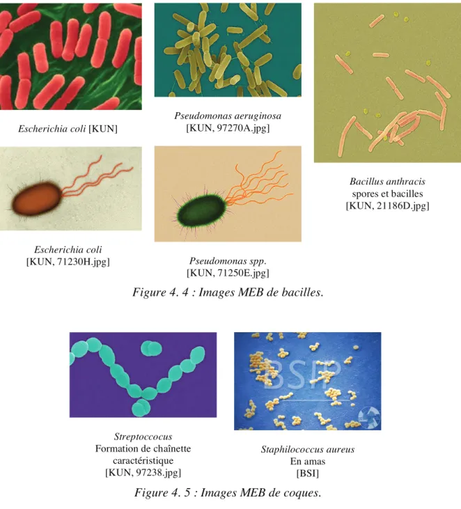 Figure 4. 4 : Images MEB de bacilles.
