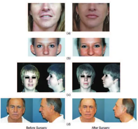 Figure 2.3 shows an example from the plastic surgery database explained in [127].