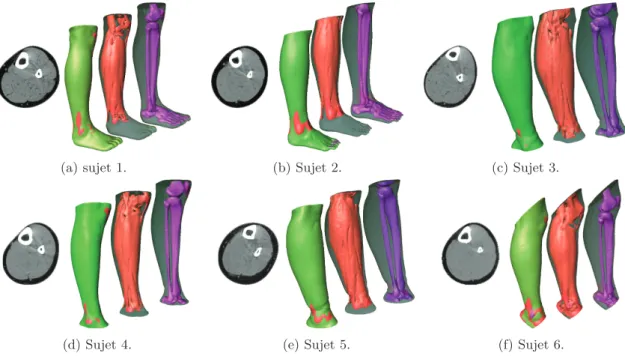 Figure IV.2 : Coupe horizontale des images scanner brutes et visualisation 3D de la segmentation pour les six jambes : contour extérieur, contour de la région 2 et contour de la région 3.