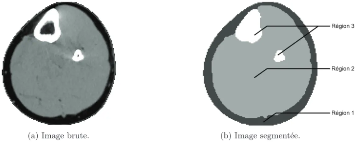 Figure II.2 : (a) Section de l’image acquise par tomodensitomètrie. (b) La même section après segmen- segmen-tation d’image : en gris foncé la région 1, en gris clair la région 2 et en blanc la région 3.