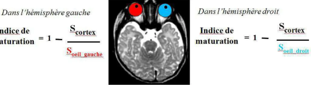 Figure 31. Normalisation du signal du cortex par le signal du corps vitreux des yeux [McArdle, 1987]