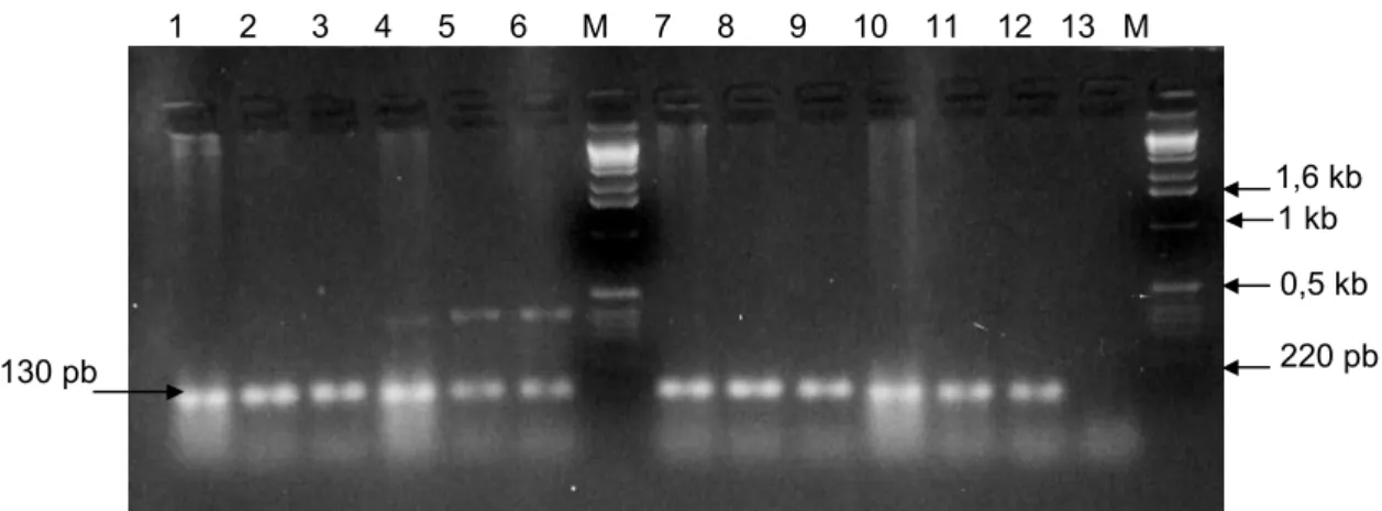 Figure 48 : Amplification par PCR avec les amorces For1 et Rev 3 d