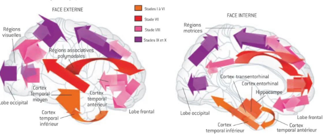 Figure 7.1 – Propagation des lésions dans le cerveau. Les lésions se propagent des régions inférieures vers les régions dites primaires, qui reçoivent les informations sensorielles ou motrices