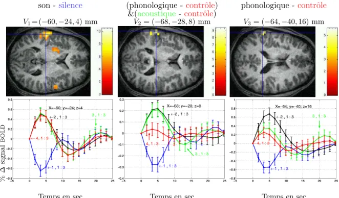 Fig. III.1 – Estimation multi-conditions et multi-sessions de la FRH dans une exp´erience de perception linguistique