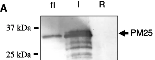 Figure 2.3: Taux de PM25 déterminé en western  blot pour les bactéries faiblement induite, induite  et réprimé (A) et effet de stress UV (B , C, D)  sur  des bactéries surexprimant ou non PM25 