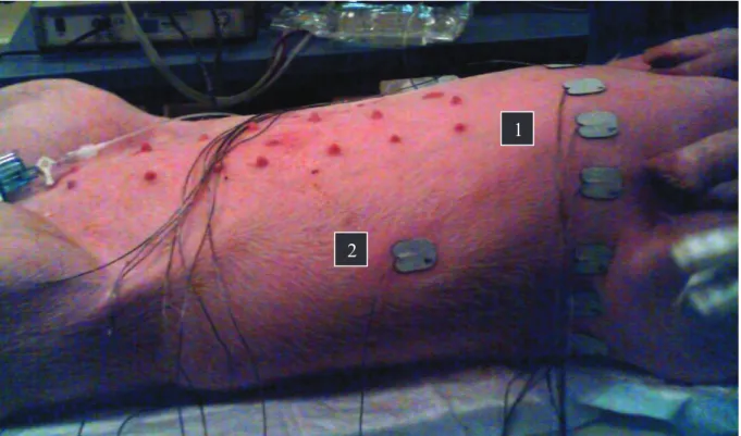 Figure 4 : Mise en place des électrodes pour l’acquisition des images en TIE sur un porc anesthésié en  décubitus dorsal 