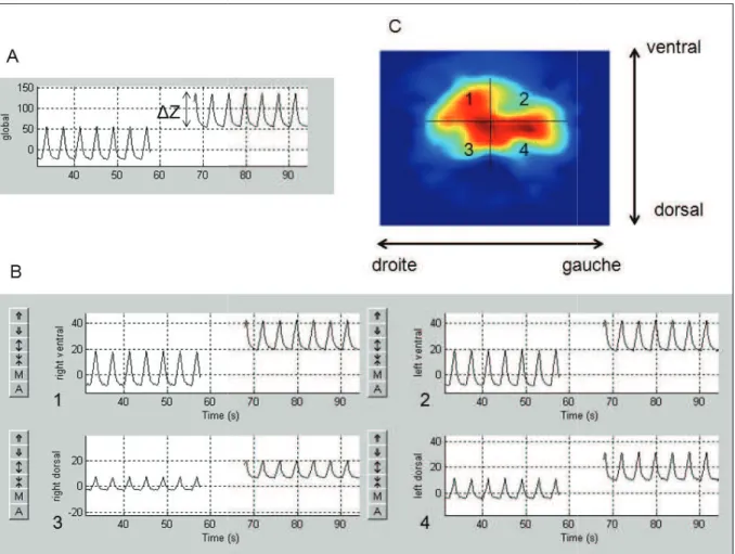 Figure 6 : Courbes représentant pulmonaire (A) et dans 4 régions d (4)), et image dynamique de TIE ( Les courbes et les régions d’in électrique 