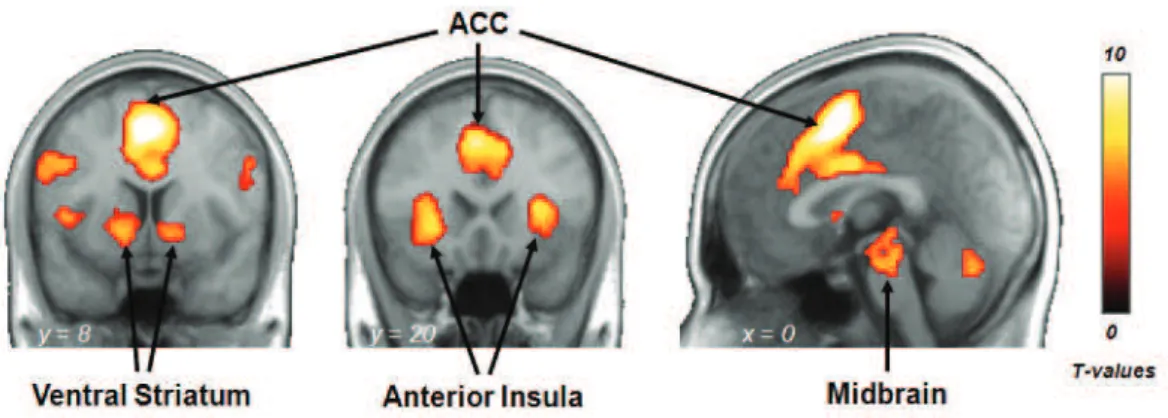 Figure S5. Brain regions responding to both monetary and erotic rewards in a simple contrast  against the control condition (conjunction of the contrasts MR&gt;C and ER&gt;C)