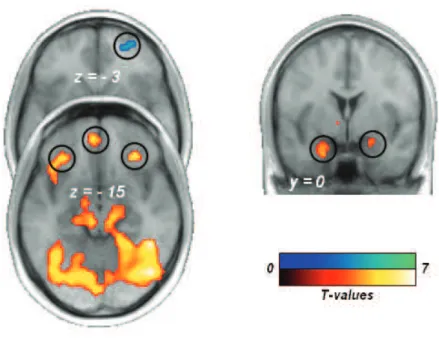 Figure S4. Brain regions in which the correlation with hedonic value was greater for one type of  reward compared to the other (comparison of parametric regressors modelling hedonic ratings  across reward and no-reward outcomes)