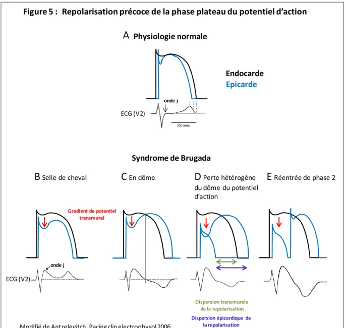 Figure 5 :  Repolarisation précoce de la phase plateau du potentiel d’action