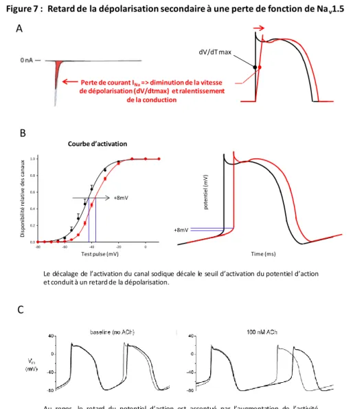 Figure 7 :  Retard de la dépolarisation secondaire à une perte de fonction de Na v 1.5
