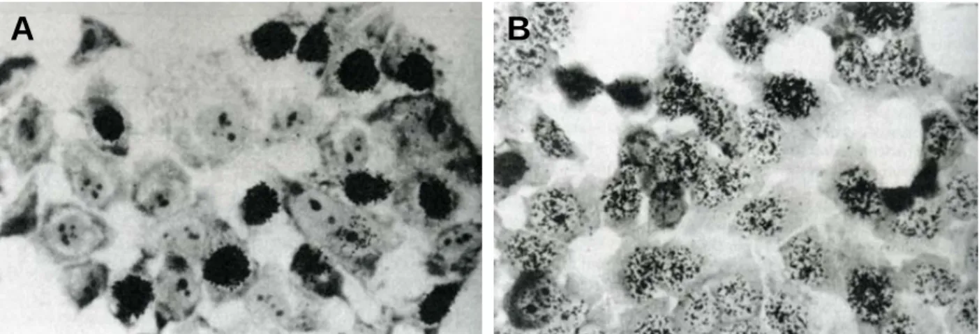 Figure 29: Les autoradiographies obtenues à la fin du test UDS réalisé sur des cellules HeLa