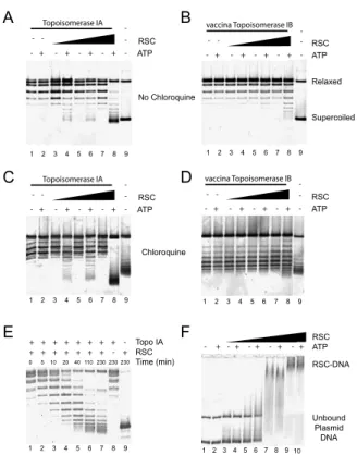 FIG. 5: Detection of unconstrained superhelical torsion in the presence of RSC. Relaxed pUC18 DNA (40ng) was inclubated in the presence of recombinant E.coli Topoisomerase Ia (A, C, E) or recombinant vaccina Topoisomerase Ib (B, D), RSC and ATP as indicate