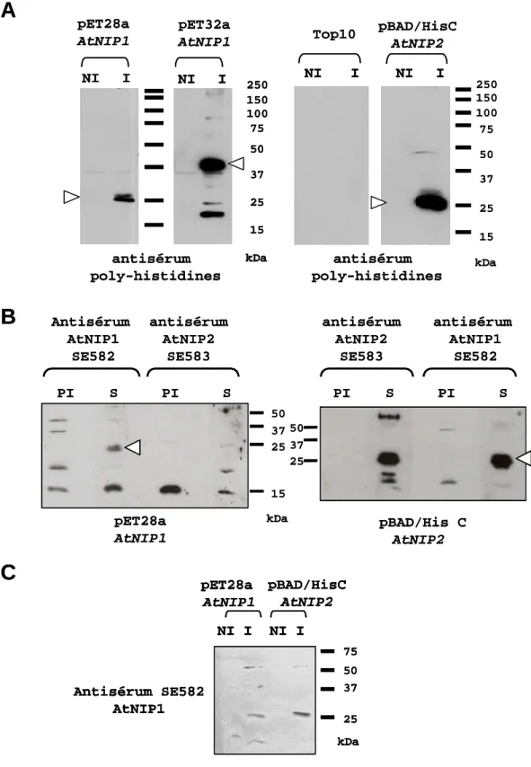 Figure 16  : Immunodétection des protéines recombinantes AtNIP1 ou AtNIP2 produites chez E