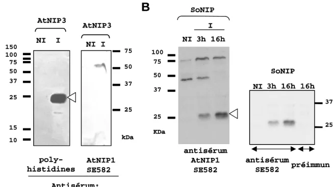 Figure 17 : Test de spécificité des anticorps anti-AtNIP1 SE582  sur les protéines recombinantes AtNIP3 (A) ou  SoNIP (B)