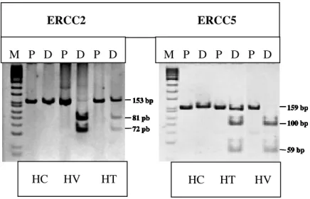 Figure 9. Exemples de profils électrophorétiques de restriction (RFLP) obtenus à partir des produits  d’amplification des régions adéquates des gènes ERCC2 et ERCC5, dans les lignées de génotype  homozygote commun (HC), hétérozygote (HT) et homozygote vari