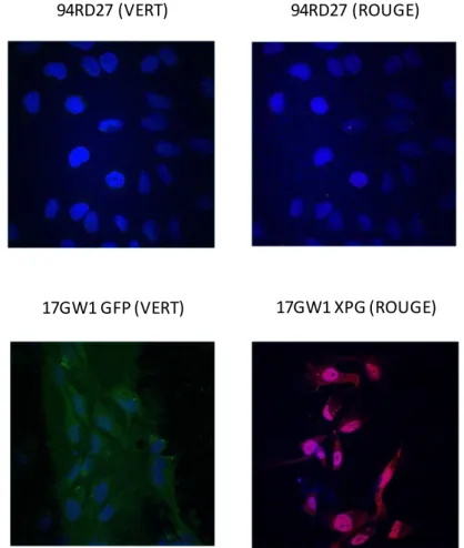 Figure 27. Microscopie confocale des fibroblastes 94RD27 non transfectés et du clone 17GW1  transfectés stable avec le vecteur pTRACER-ERCC5-WT
