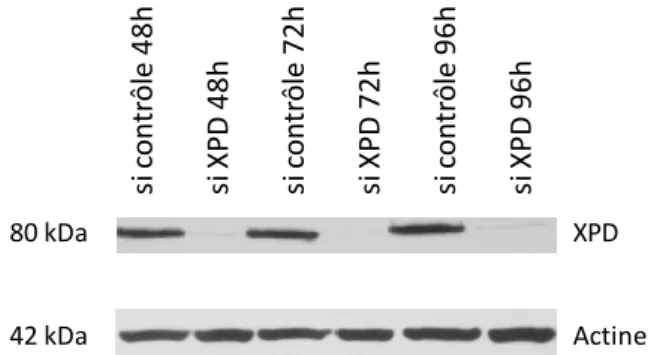 Figure  38. Western blot montrant une cinétique d’extinction de la protéine XPD entre 48 et 96 h   après transfection par des siRNA dirigés contre le messager de ERCC2, dans la lignée XP6BE