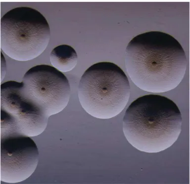 Figure  2  :  Observation de  colonies  de  Mycoplasma  mycoides  subsp.  mycoides  cultivées  en  milieu  gélosé