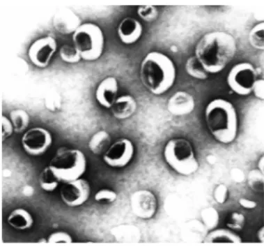 Figure 20 : Suspension de DT3TU/DPPC 1/2 observée au microscope en trasmission électronique  (agent de constraste : acétate d’uranyle) 