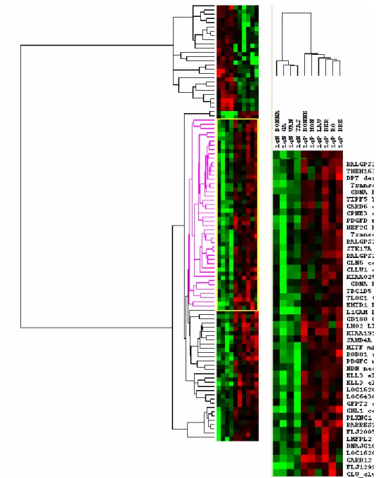 Figure 3 : Dendrogramme issu de l’analyse supervisée de 10 cas de DLBCL avec réarrangement de  l’hétérochromatine 1q12 (1qP) ou en l’absence de réarrangement 1q (1qN)