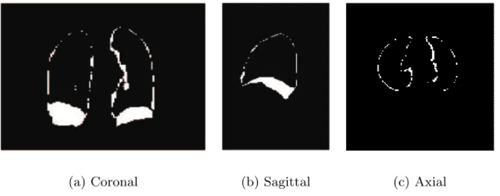 Figure 6.21: Absolute image difference between lungs image segmentation at x + 3 √ λ 1 and x − 3 √