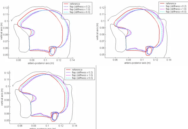 Figure  9:  Co-contraction  of  the  posterior  genioglossus,  styloglossus  and  transversus