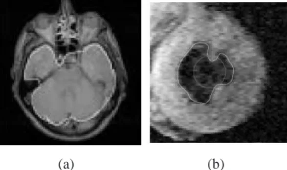 Figure 3.1 — Examples of deformable segmentation images both for the brain case (a) and the left ventricle case (b)