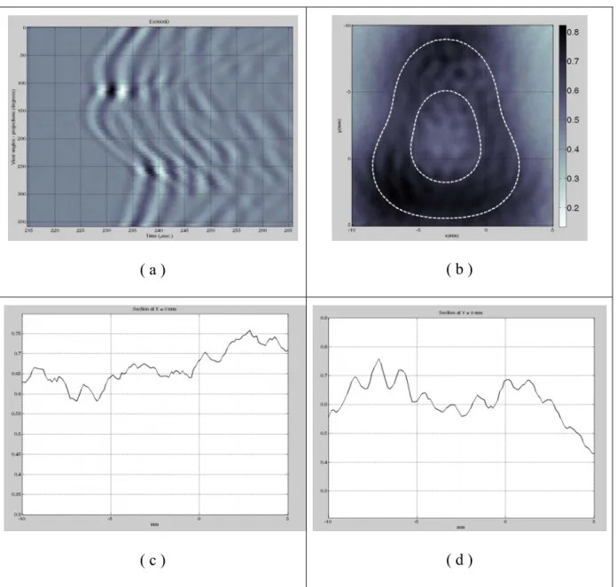 Figure 8: Ultrasonic first-order Born reflection tomography of the non-circular elastic tube