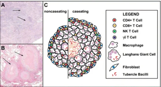 Figure 11 :  Structure du granulome mycobactérien. Images microscopiques (A-B) et diagramme  (C) de granulomes non caséeux humains (A et C) et de granulomes caséeux humains (B).(Co, Hogan  et al