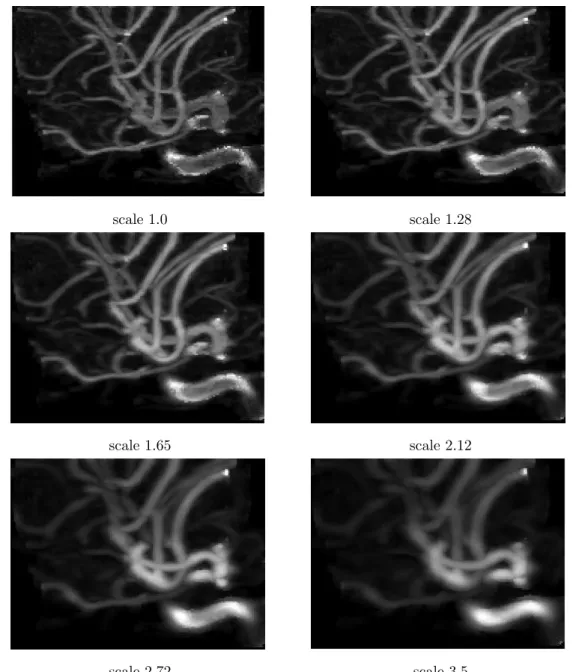 Figure 5: MIP views of the responses obtained for 6 scales.