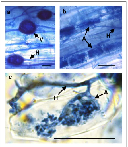 Abb. 1.2  Darstellung der intraradikalen AM-Pilzstrukturen 