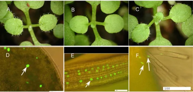 Figure 10: Rescue of gl2 with pGL2::EYFP:GL2 construct and sub-cellular localization of EYFP-GL2 protein  The pGL2::EYFP-GL2 construct rescues the gl2 mutant phenotype completely (C)