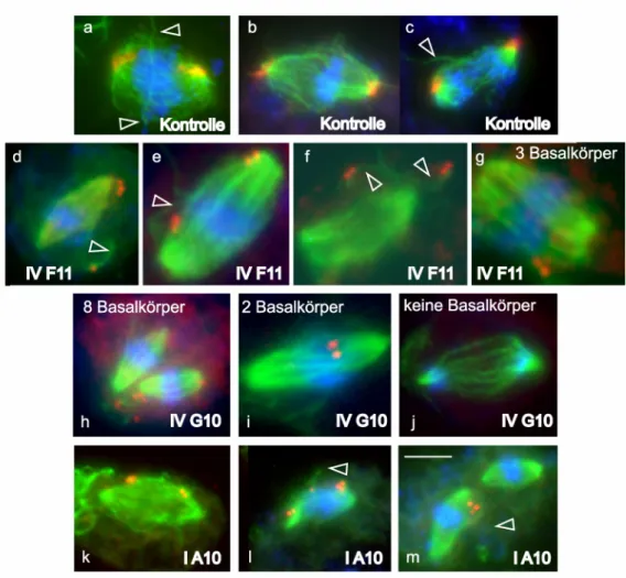 Abbildung 5: Fluoreszenzaufnahmen von Kontroll- und RNAi-Zellen während der Mitose 