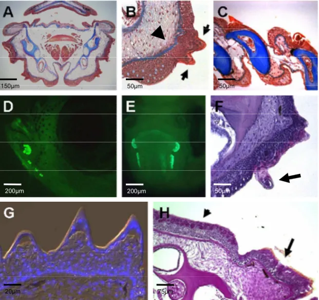 Figure 6: Distribution pattern and general structure of breeding tubercles in zebrafish: (A) Azan trichrome staining  of  a  section  of  the  anterior  head