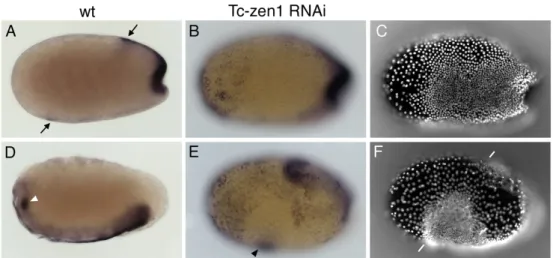 Fig. 6. The amnion covers the embryo at the dorsal side of Tc-zen1 RNAi  embryos.  
